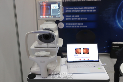 망막 사진으로 심혈관 질환 위험 예측 가능