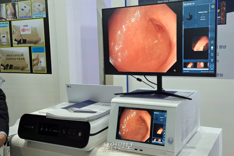 카이미, AI 내시경 진단기 ‘알파온’ 선봬…조기 종양 진단 지원