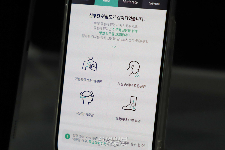 AI로 목소리 떨림에서 심부전 위험 포착