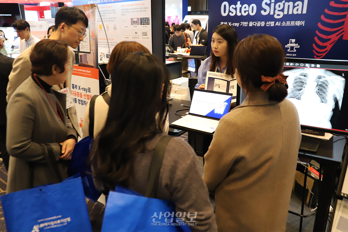 AI가 흉부 X-ray로 골다공증 조기 예측 - 뉴스 썸네일 이미지